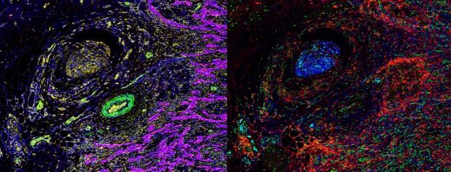 illustrations_hyperion